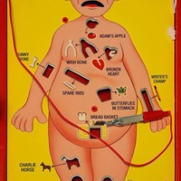 Operation, Sorry & The Pop-O-Matic Bubble... board game randomness